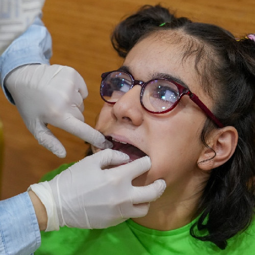 Keçiören Belediyesi özel gereksinimli bireylere ağız ve diş sağlığı kontrolü yaptırdı - Resim : 2