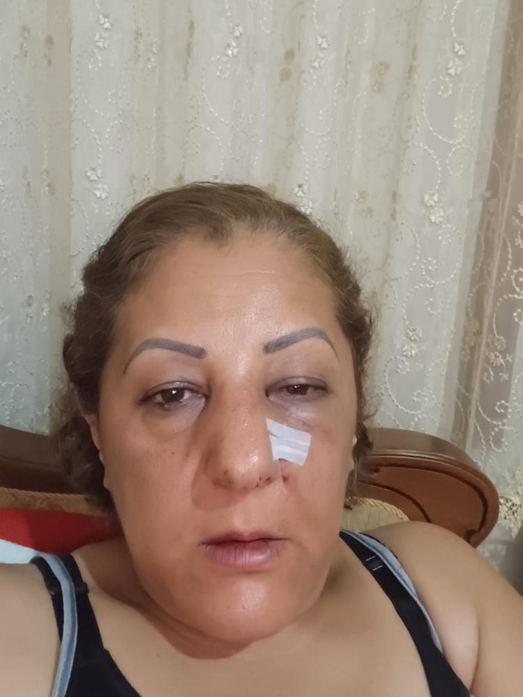 Yenimahalle'de komşular arasında kedi besleme kavgası!